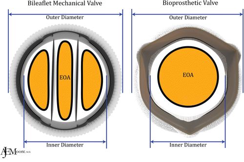 EOA bioloska vs mehanicka