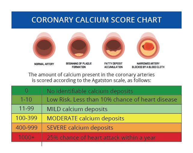 vrednost kalcijum skora i rizik od koronarne bolesti