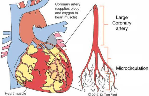 mikrovaskularna angina