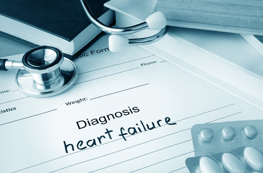srcana slabost dijagnoza