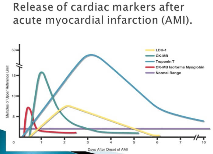 biomarkeri u infarktu
